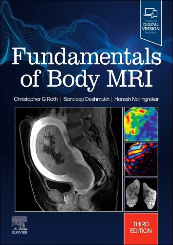 Бумажная книга «Fundamentals of Body MRI», авторов Кристофер Г. Рот, Хареш Нарингрекар, Сандип Дешмукх - фото №1