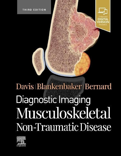 Паперова книга «Diagnostic Imaging: Musculoskeletal Non-Traumatic Disease», авторів Донна Г. Бланкенбейкер, Кіркленд В. Девіс, Стефані Бернар - фото №1