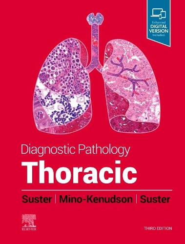 Бумажная книга «Diagnostic Pathology: Thoracic», авторов Дэвид Састер, Мари Мино-Кенудсон, Сол Састер - фото №1