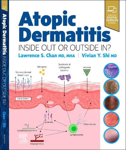 Паперова книга «Atopic Dermatitis: Inside Out or Outside In» - фото №1
