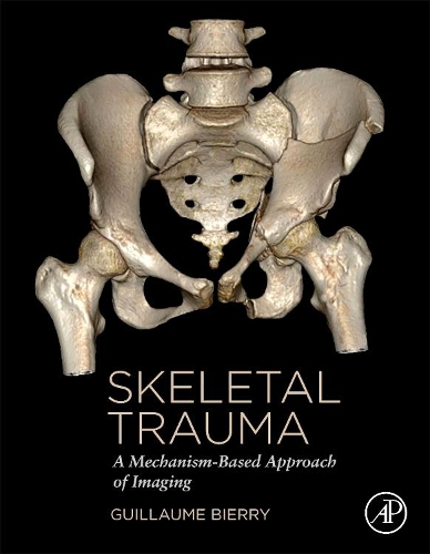 [object Object] «Skeletal Trauma: A Mechanism-Based Approach of Imaging», автор Гийом Бьерри - фото №1