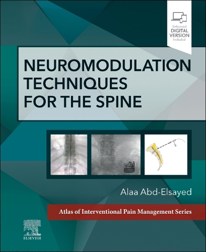 [object Object] «Neuromodulation Techniques for the Spine: A Volume in the Atlas of Interventional Pain Management Series», автор Алаа Абд-Эльсайед - фото №1