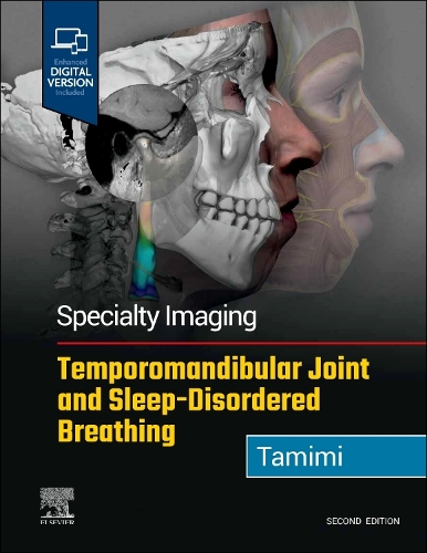 Бумажная книга «Specialty Imaging: Temporomandibular Joint and Sleep-Disordered Breathing», автор Даня Тамими - фото №1