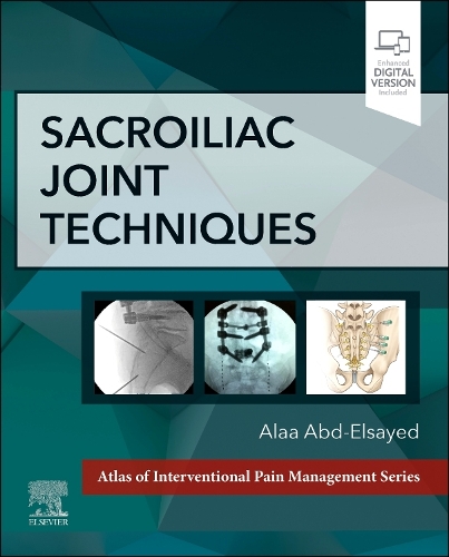 Паперова книга «Sacroiliac Joint Techniques», автор Алаа Абд-Ельсаїд - фото №1