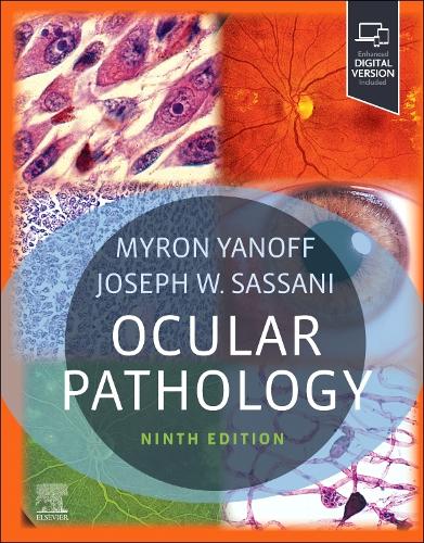 Бумажная книга «Ocular Pathology», авторов Джозеф В. Сассани, Мирон Янофф - фото №1