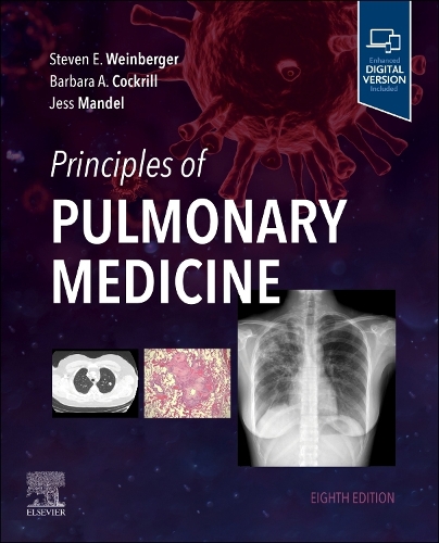 Бумажная книга «Principles of Pulmonary Medicine», авторов Барбара А. Кокрилл, Джесс Мандел, Стивен Э. Вайнбергер - фото №1