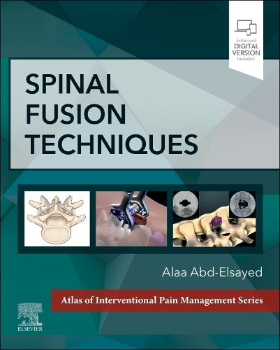 [object Object] «Spinal Fusion Techniques», автор Алаа Абд-Эльсайед - фото №1