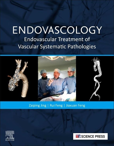 Бумажная книга «Endovascology: Endovascular Treatment of Vascular Systematic Pathologies», авторов Цзясюань Фэн, Руй Фэн, Заипин Цзин - фото №1