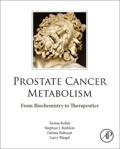 Бумажная книга «Prostate Cancer Metabolism: From Biochemistry to Therapeutics», авторов Фатима Балтазар, Ларри Флигель, Стефан Дж. Решкин, Томаш Колтаи - фото №1