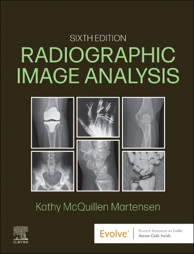 Бумажная книга «Radiographic Image Analysis», автор Кэти МакКиллен-Мартенсен - фото №1