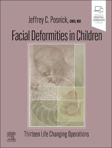 Паперова книга «Facial Deformities in Children: Thirteen Life Changing Operations», автор Джеффрі К. Поснік - фото №1