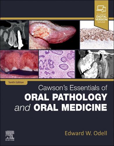 Бумажная книга «Cawson's Essentials of Oral Pathology and Oral Medicine», автор Эдвард У. Оделл - фото №1