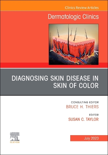 Паперова книга «Diagnosing Skin Disease in Skin of Color, An Issue of Dermatologic Clinics» - фото №1