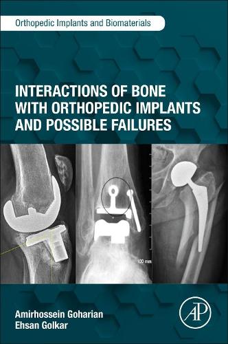 Бумажная книга «Interactions of Bone with Orthopedic Implants and Possible Failures», авторов Амирхоссейн Гохарян, Эхсан Голкар - фото №1