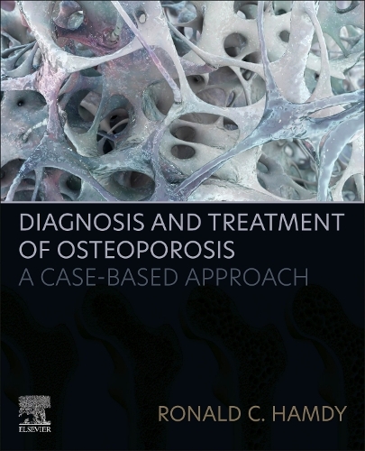 Бумажная книга «Diagnosis and Treatment of Osteoporosis: A Case-Based Approach», автор Рональд К. Хэмди - фото №1