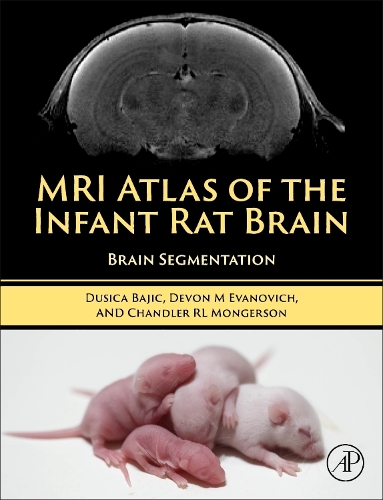 Бумажная книга «MRI Atlas of the Infant Rat Brain: Brain Segmentation», авторов Чандлер Монгерсон, Девон Эванович, Душица Баич - фото №1