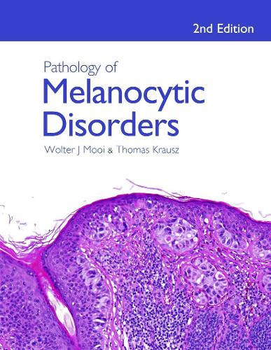 Паперова книга «Pathology of Melanocytic Disorders 2ed», авторів Томас Крауш, Волтер Муй - фото №1