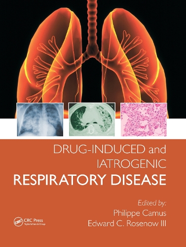 Паперова книга «Drug-induced and Iatrogenic Respiratory Disease», авторів Едвард Розенов III, Філіп Камю - фото №1