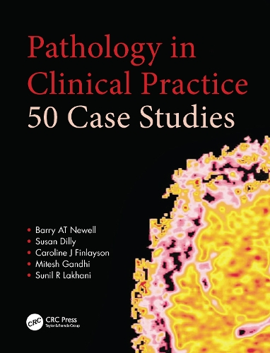 Бумажная книга «Pathology in Clinical Practice: 50 Case Studies», авторов Барри АТ Ньюэлл, Кэролайн Финлейсон, Митеш Ганди, Сунил Лакхани, Сьюзен Дилли - фото №1