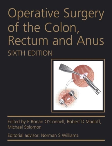 Бумажная книга «Operative Surgery of the Colon, Rectum and Anus», авторов Майкл Соломон, П. Ронан О'Коннелл, Роберт Д. Мэдофф - фото №1
