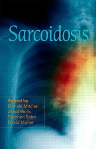 Паперова книга «Sarcoidosis» - фото №1