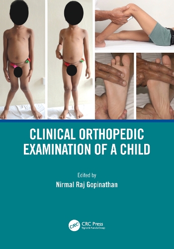 Паперова книга «Clinical Orthopedic Examination of a Child» - фото №1