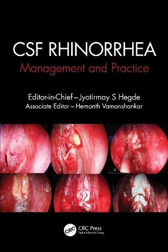Паперова книга «CSF Rhinorrhoea: Management and Practice» - фото №1