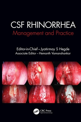 Паперова книга «CSF Rhinorrhoea: Management and Practice» - фото №1