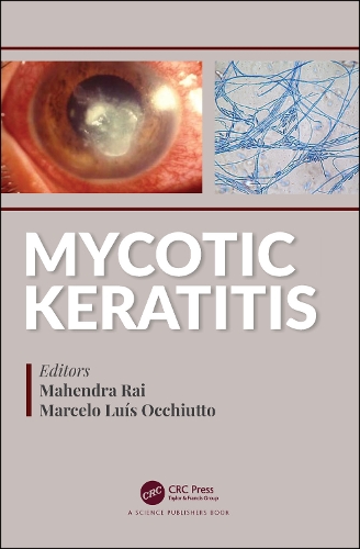 Паперова книга «Mycotic Keratitis» - фото №1