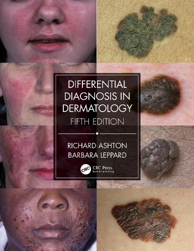 Бумажная книга «Differential Diagnosis in Dermatology», автор Барбара Леппард - фото №1