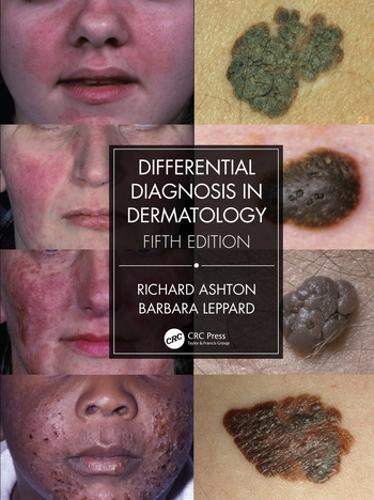 Бумажная книга «Differential Diagnosis in Dermatology», автор Барбара Леппард - фото №1