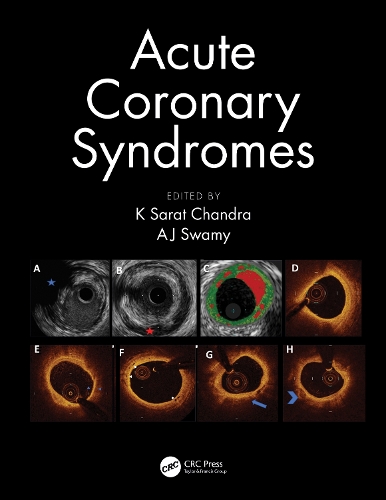Паперова книга «Acute Coronary Syndromes» - фото №1
