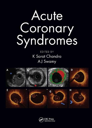 Бумажная книга «Acute Coronary Syndromes» - фото №1