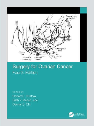 Паперова книга «Surgery for Ovarian Cancer» - фото №1
