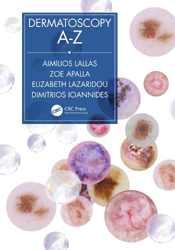 Паперова книга «Dermatoscopy A-Z», авторів Айміліос Лаллас, Дімітріос Іоаннідес, Елізабет Лазаріду, Зої Апалла - фото №1