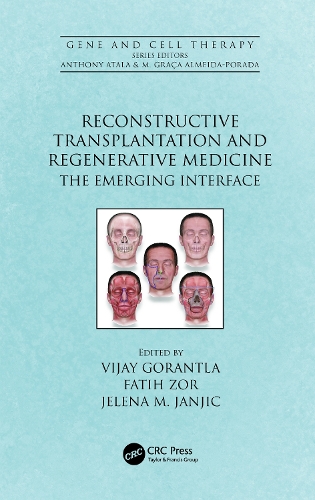 Паперова книга «Reconstructive Transplantation and Regenerative Medicine: The Emerging Interface» - фото №1