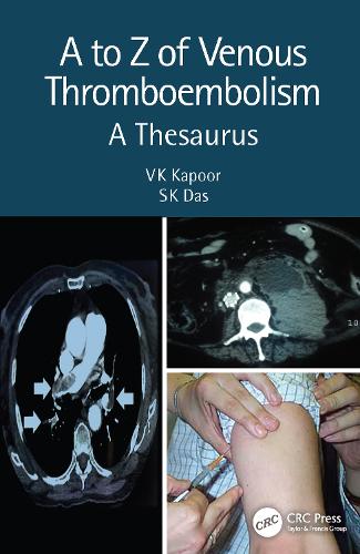 Бумажная книга «A to Z of Venous Thromboembolism: A Thesaurus», авторов СК Дас, В.К. Капур - фото №1