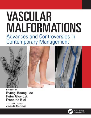 Бумажная книга «Vascular Malformations: Advances and Controversies in Contemporary Management» - фото №1