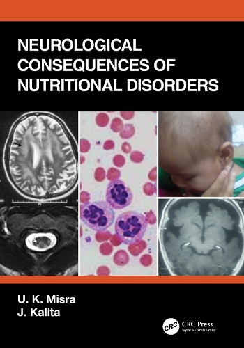 Паперова книга «Neurological Consequences of Nutritional Disorders», авторів Дж. Каліта, У. К. Місра - фото №1