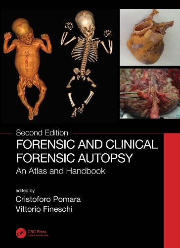 Паперова книга «Forensic and Clinical Forensic Autopsy: An Atlas and Handbook» - фото №1