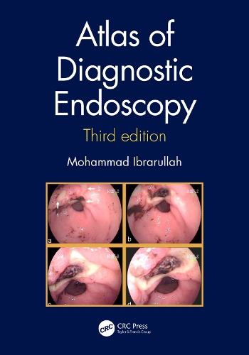Бумажная книга «Atlas of Diagnostic Endoscopy, 3E», автор Мохаммад Ибрарулла - фото №1