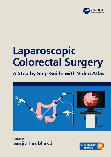 Паперова книга «Laparoscopic Colorectal Surgery: A Step by Step Guide with Video Atlas» - фото №1