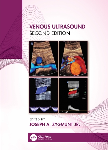 Паперова книга «Venous Ultrasound» - фото №1