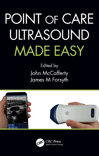 Паперова книга «Point of Care Ultrasound Made Easy» - фото №1