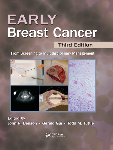 Паперова книга «Early Breast Cancer: From Screening to Multidisciplinary Management, Third Edition» - фото №1
