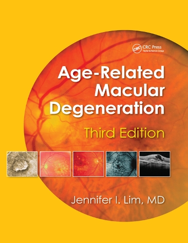 Бумажная книга «Age-Related Macular Degeneration» - фото №1