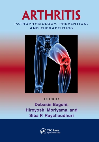 Паперова книга «Arthritis: Pathophysiology, Prevention, and Therapeutics» - фото №1