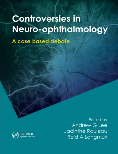 Бумажная книга «Controversies in Neuro-Ophthalmology» - фото №1