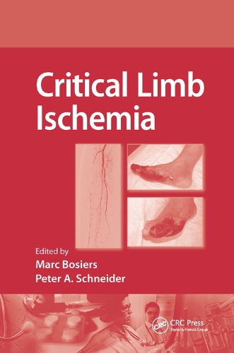 Бумажная книга «Critical Limb Ischemia» - фото №1