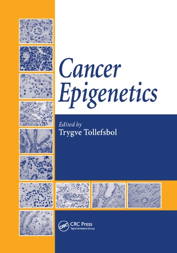 Паперова книга «Cancer Epigenetics» - фото №1